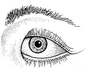 Epicanthic Definition Of Epicanthic By Medical Dictionary Epicanthal folds are skin folds that may cover the inside corners of the eye. epicanthic by medical dictionary
