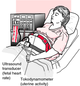 External fetal hot sale heart monitor