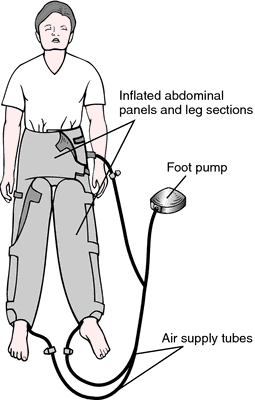 Nonpneumatic AntiShock Garment NASG Photo A model in an NASG   Download Scientific Diagram