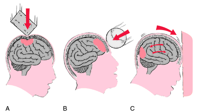 Head Anatomy Definition Of Head Anatomy By Medical Dictionary