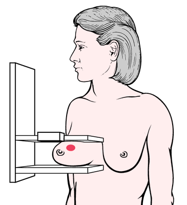 Definition of nipple - NCI Dictionary of Cancer Terms - NCI