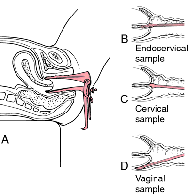 Papanicolaou Technique