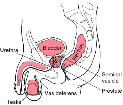 Cancer de prostată - Wikipedia