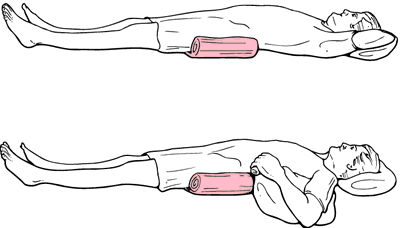 trochanter roll placement