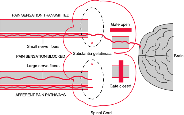 gate control theory of pain diagram