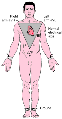 Einthoven's triangle projected onto the human body