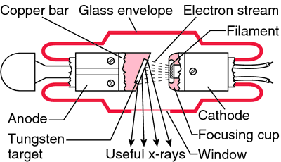 megavoltage x rays