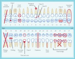 Dental Examination Chart