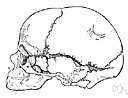 Anterior fontanelle - definition of anterior fontanelle by The Free ...