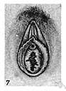 hymen - a fold of tissue that partly covers the entrance to the vagina of a virgin