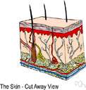 skin tumor - a neoplasm originating in the epidermis