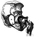 acetabular - of the cup-shaped socket that receives the head of the thigh bone