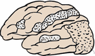 encephalopathy - any disorder or disease of the brain