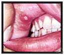 aetiology - the cause of a disease