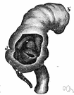 ileum - the part of the small intestine between the jejunum and the cecum