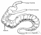 Worm-shaped - resembling a worm
