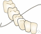 floss - a soft thread for cleaning the spaces between the teeth