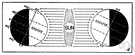 siriasis - sudden prostration due to exposure to the sun or excessive heat