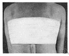 plaster - adhesive tape used in dressing wounds