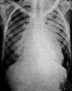 X-ray photography - radiography that uses X-rays to produce a roentgenogram