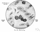 Activase - a thrombolytic agent (trade name Activase) that causes fibrinolysis at the site of a blood clot