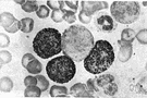 monocyte - a type of granular leukocyte that functions in the ingestion of bacteria