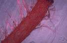 vena - a blood vessel that carries blood from the capillaries toward the heart