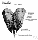 ethmoid - one of the eight bones of the cranium