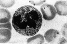 leukocyte - blood cells that engulf and digest bacteria and fungi