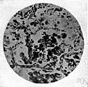 Macrophage Definition Of Macrophage By The Free Dictionary