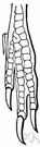 syndactylism - birth defect in which there is partial or total webbing connecting two or more fingers or toes