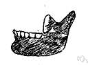alveolar arch - the part of the upper or lower jawbones in which the teeth are set